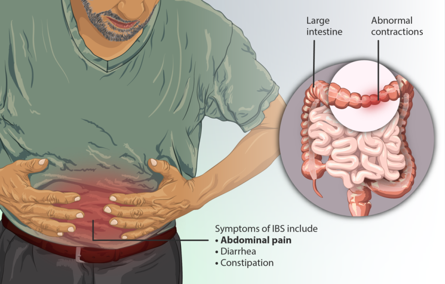 File:Depiction of a person suffering from Irritable Bowel Syndrome (IBS).png by https://www.myupchar.com/en is licensed under CC BY-SA 4.0.